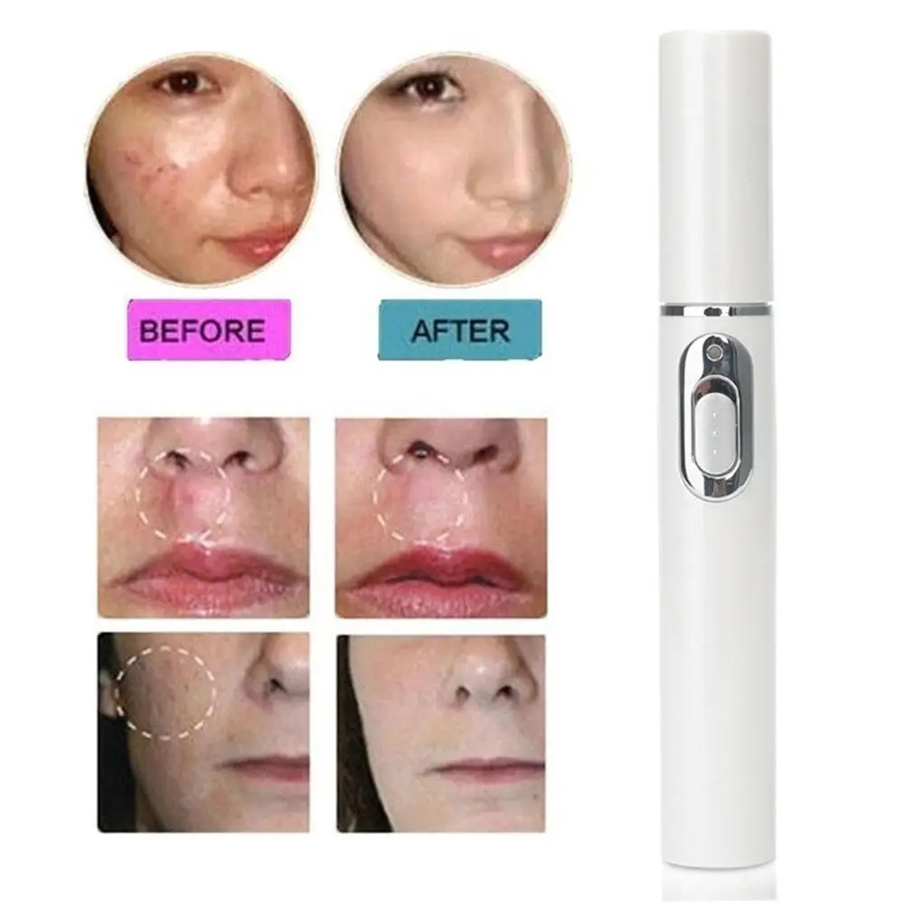 Blue Light Therapy Acne Laser Pen LED Face Light Therapy For Scar Wrinkle Remova Review 2026: 240 Verified Reviews
